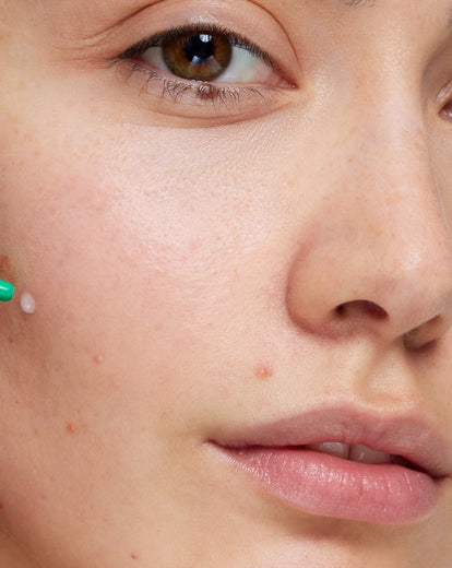 Routine SOS Imperfections