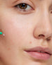 Tratamiento Flash Imperfecciones